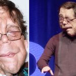 The incredible story of actor Adam Pearson: He’s an inspiration to millions