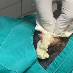 Sebaceous Cysts: Causes, Treatment Options, and When to See a Doctor