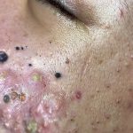 Should You Wash Your Face in the Morning?