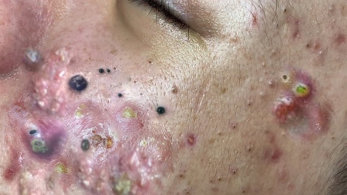 Should You Wash Your Face in the Morning?
