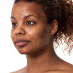 Common Skin Problems