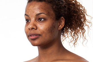 Common Skin Problems