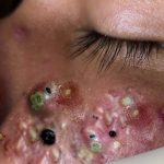 A Body Care Routine for Dry Skin